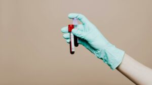 Illustration. Blood samples. Photo: Pexels/Karolina Grabowska