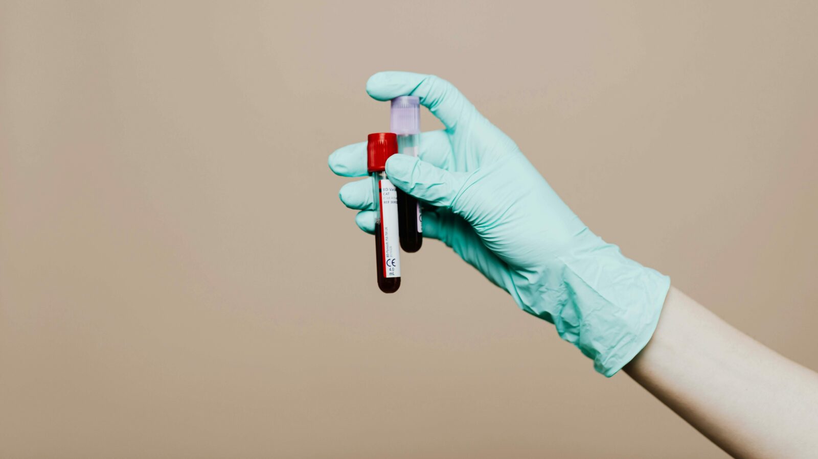 Illustration. Blood samples. Photo: Pexels/Karolina Grabowska